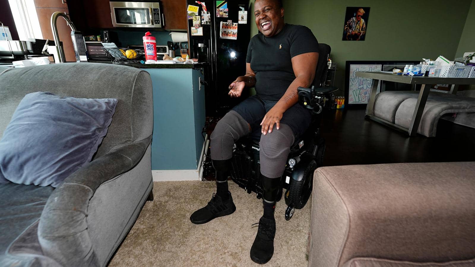 Police recruit who lost both legs in ‘barbaric hazing ritual’ sues Denver, paramedics and officers