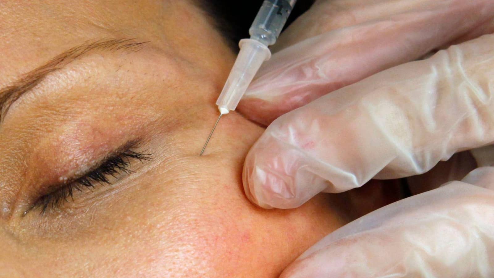 US health officials warn of counterfeit Botox injections